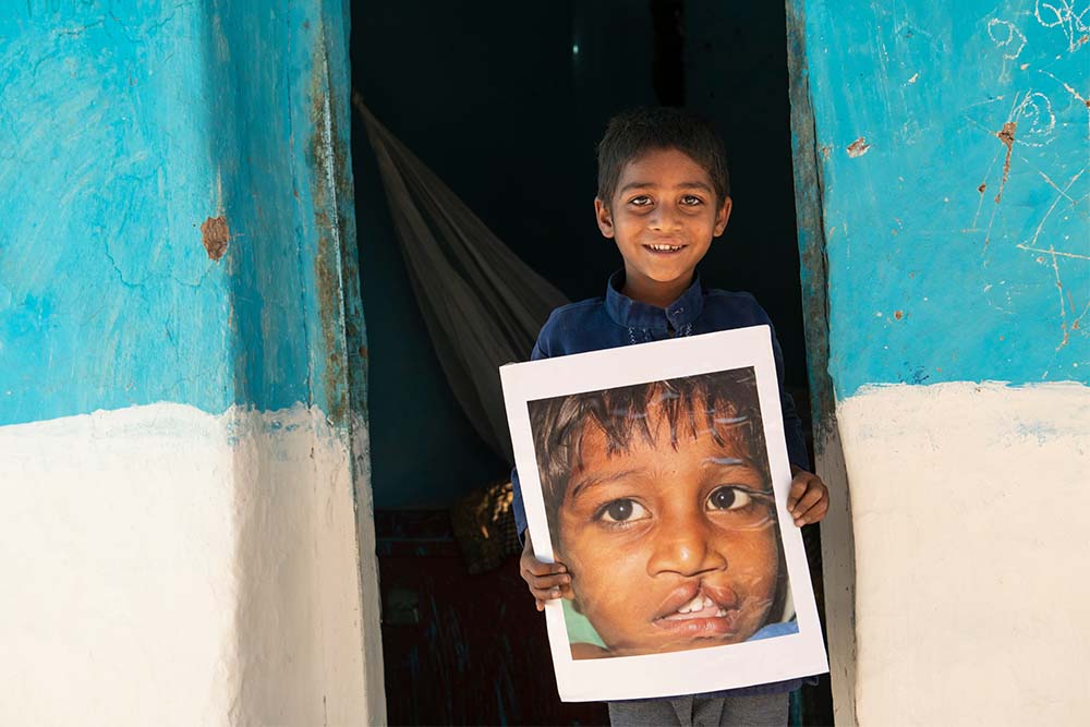 Sahil holds the image of himself before cleft lip surgery in front of home