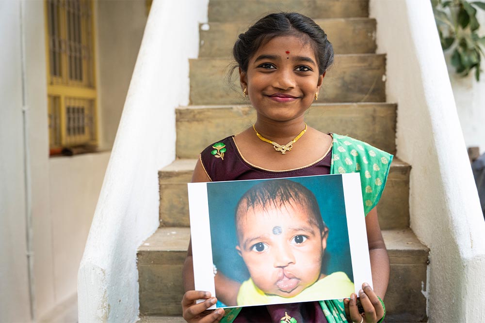 Akshara smiling and holding a photo of herself before cleft surgery