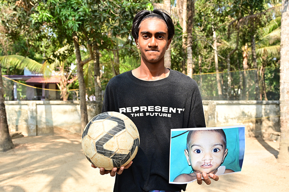 Rayan holds a football and a picture of himself before surgery