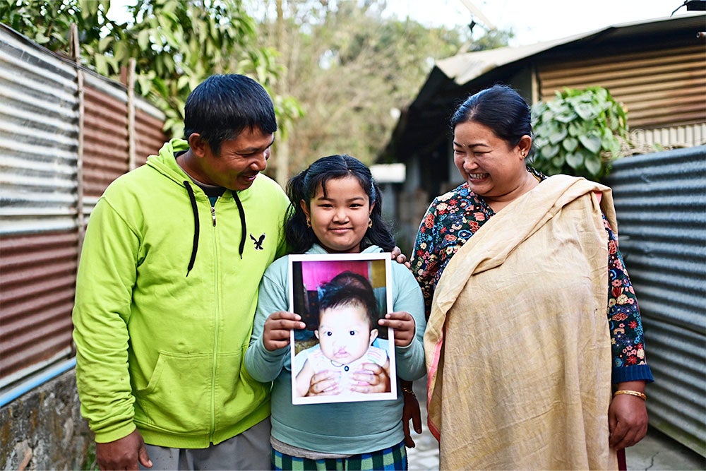 Bena smiling with her parents and holding a picture of herself before cleft surgery