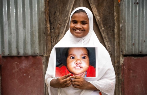 Rajiya smiling and holding a photo of herself before cleft surgery