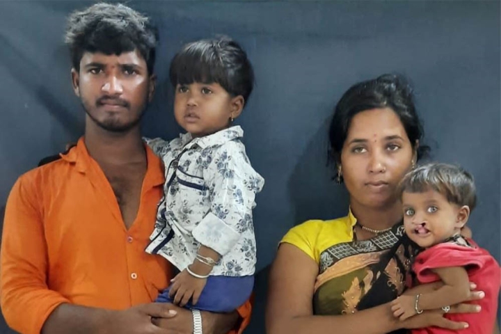 Aarohi before cleft surgery with her mother Sonali and father Arjun