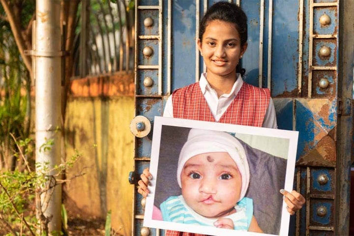 Bhargavi holding a picture of herself before cleft surgery