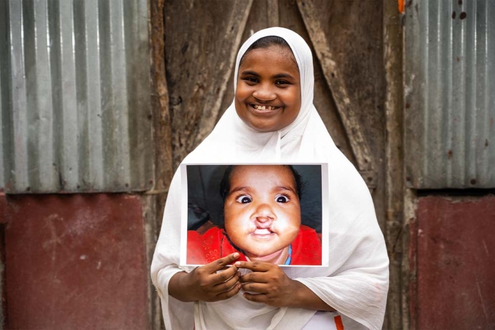 Rajiya smiling and holding a photo of herself before cleft surgery