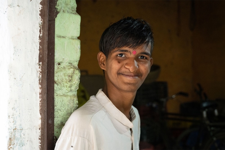 Sujal smiling after cleft surgery