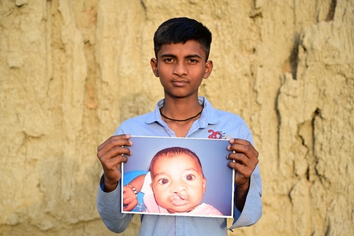 Monu smiling and holding a photo of himself from before cleft surgery