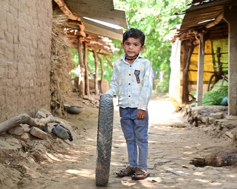 Jairaj after cleft surgery